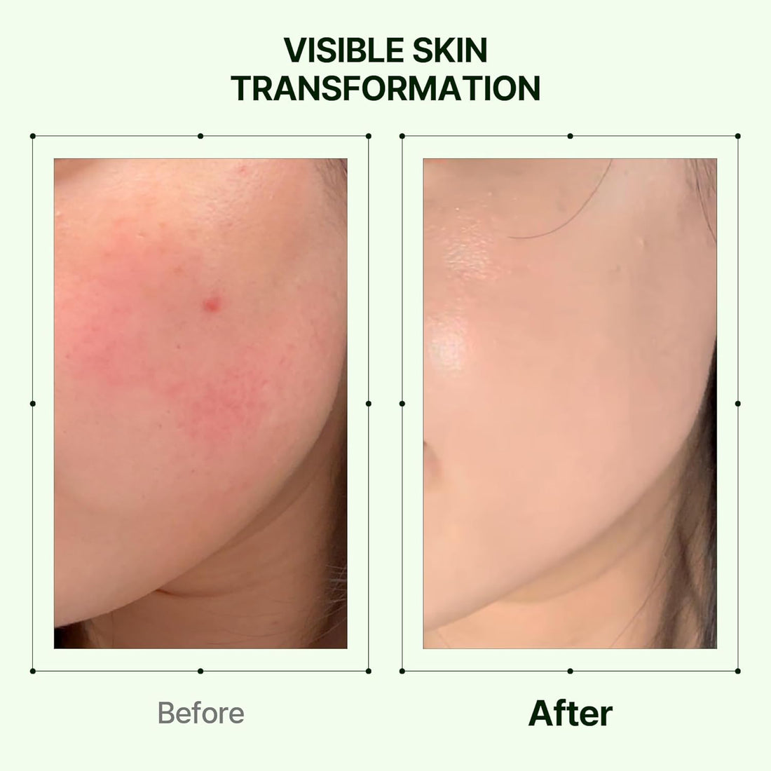 Mugwort Zero Film Moisturizer