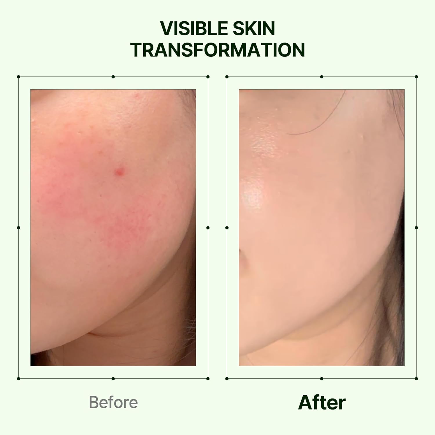 Mugwort Zero Film Moisturizer