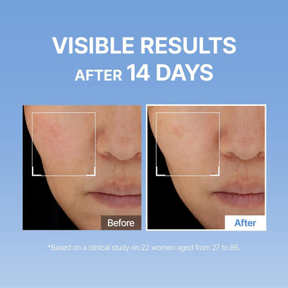 Hyaluronic Acid - Plump &amp; Glow 