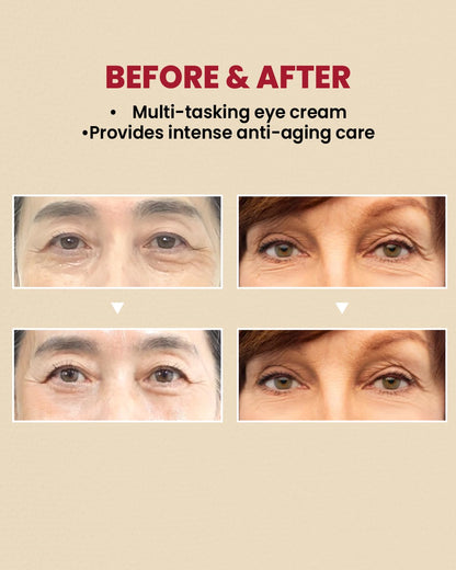 Eye Cream – Retinal 4% + Fermented Bean