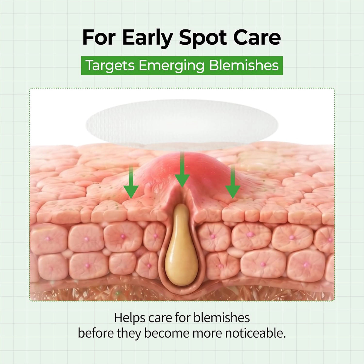 Blemish Control patch photo or benefits