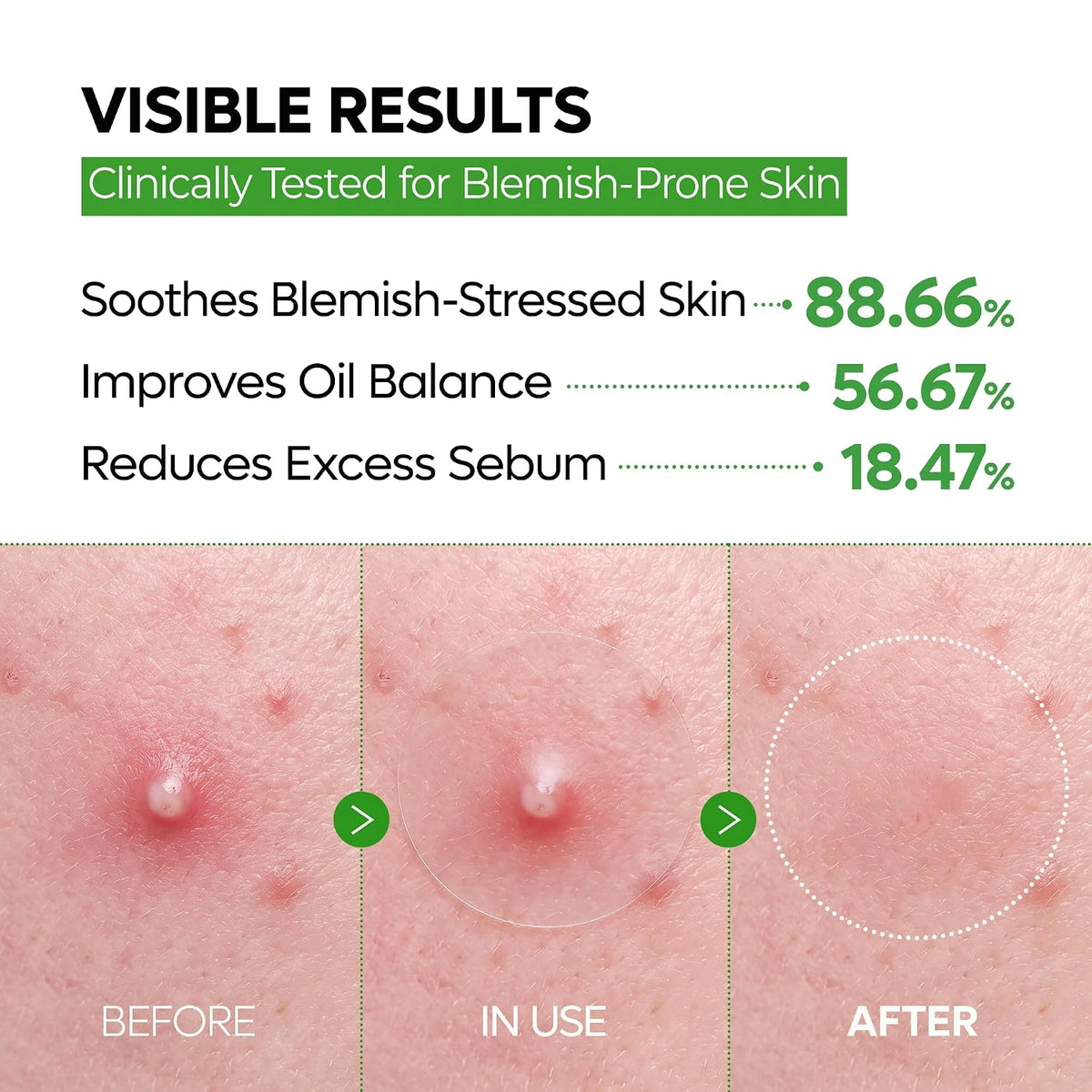 Blemish Control patch photo or benefits