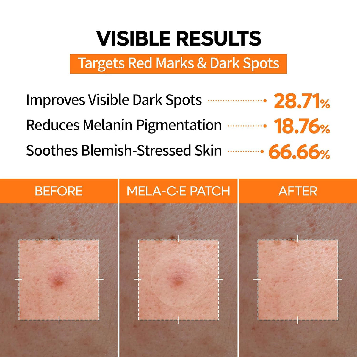 Dark Spot Care patch photo or results